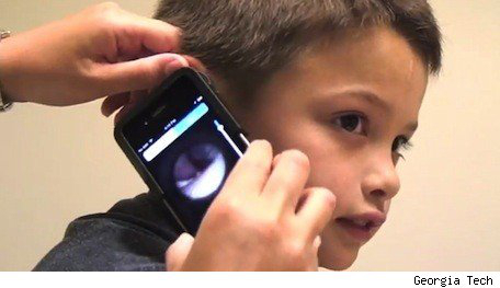 Remotoscope : accessoire iPhone pour détecter les infections de l’oreille
